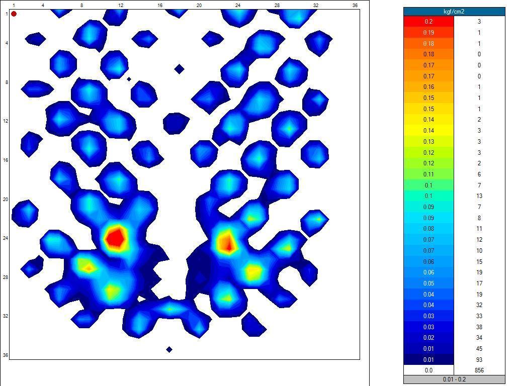 Post Rectal Cancer Cut Out Cushion Made in the UK Putnams